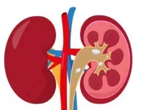Kidney Treatment in India
